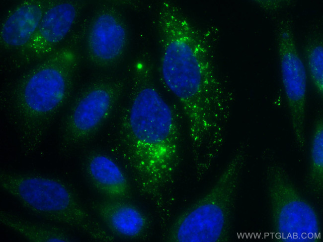 SLC9A9 Antibody in Immunocytochemistry (ICC/IF)