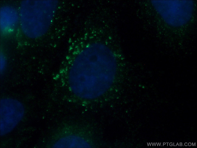 SLC9A9 Antibody in Immunocytochemistry (ICC/IF)