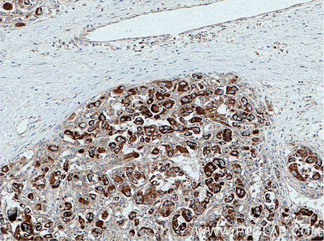 SLC9A9 Antibody in Immunohistochemistry (Paraffin) (IHC (P))