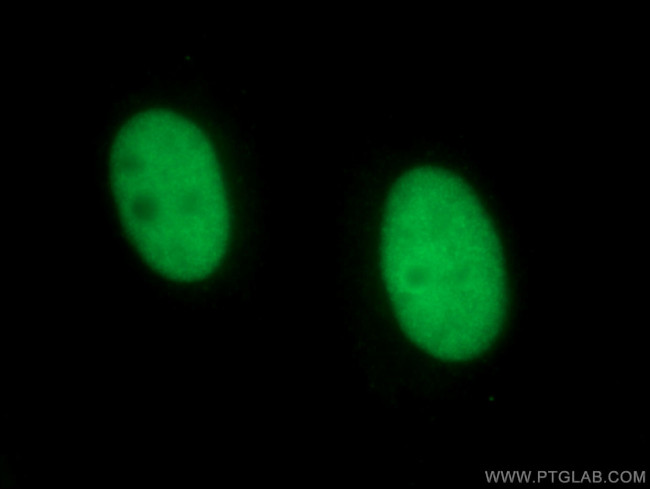 NSUN2 Antibody in Immunocytochemistry (ICC/IF)