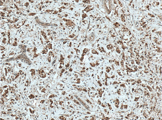 NSUN2 Antibody in Immunohistochemistry (Paraffin) (IHC (P))