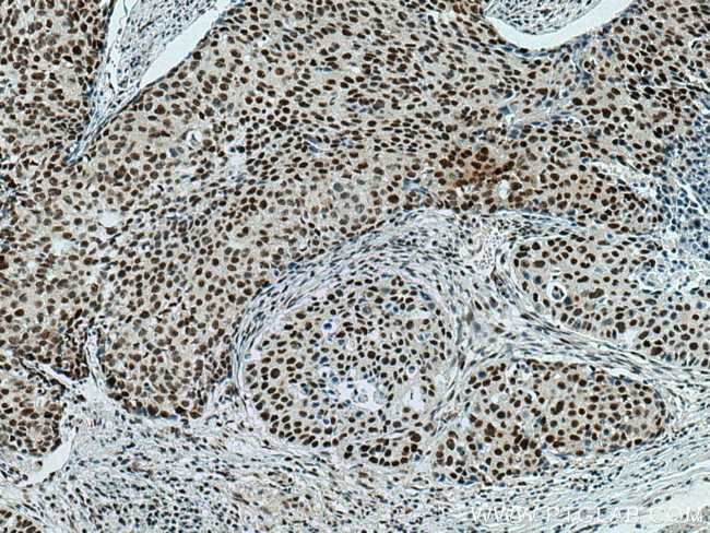 NSUN2 Antibody in Immunohistochemistry (Paraffin) (IHC (P))