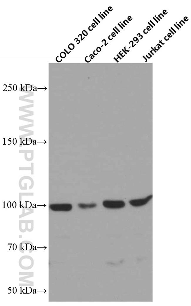 NSUN2 Antibody in Western Blot (WB)