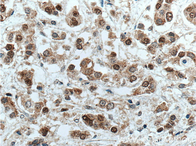 NSUN2 Antibody in Immunohistochemistry (Paraffin) (IHC (P))