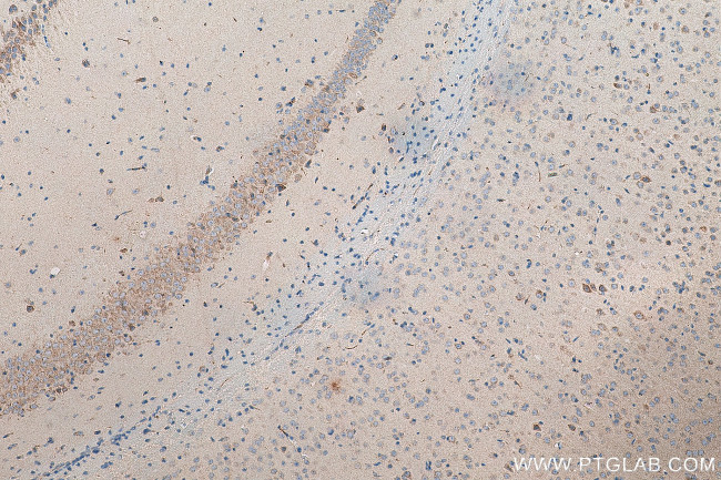 OPA1 Antibody in Immunohistochemistry (Paraffin) (IHC (P))