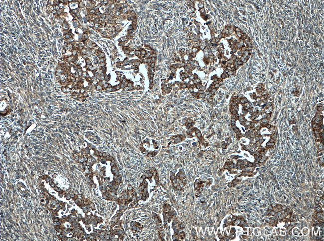 CHCHD5 Antibody in Immunohistochemistry (Paraffin) (IHC (P))