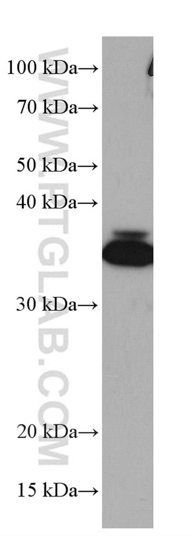 WBP2 Antibody in Western Blot (WB)