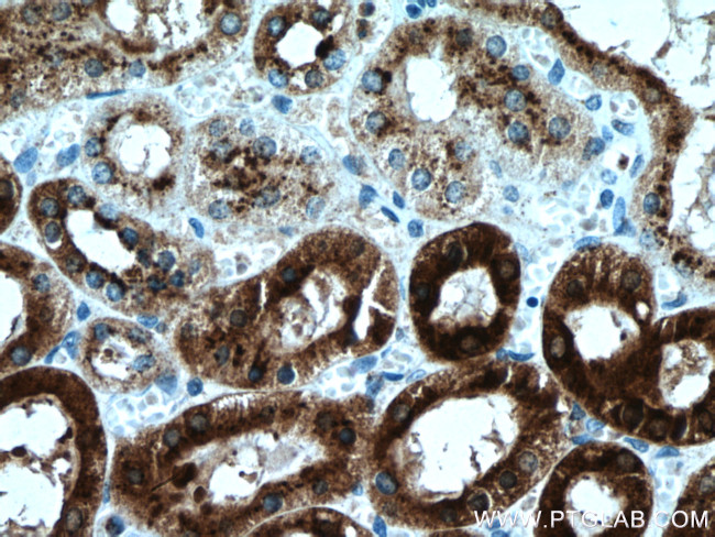 Beta galactosidase Antibody in Immunohistochemistry (Paraffin) (IHC (P))