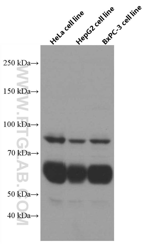 Beta galactosidase Antibody in Western Blot (WB)