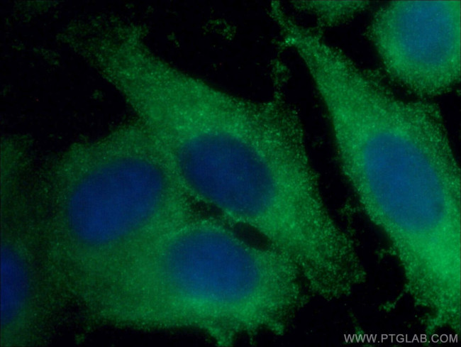 Beta galactosidase Antibody in Immunocytochemistry (ICC/IF)