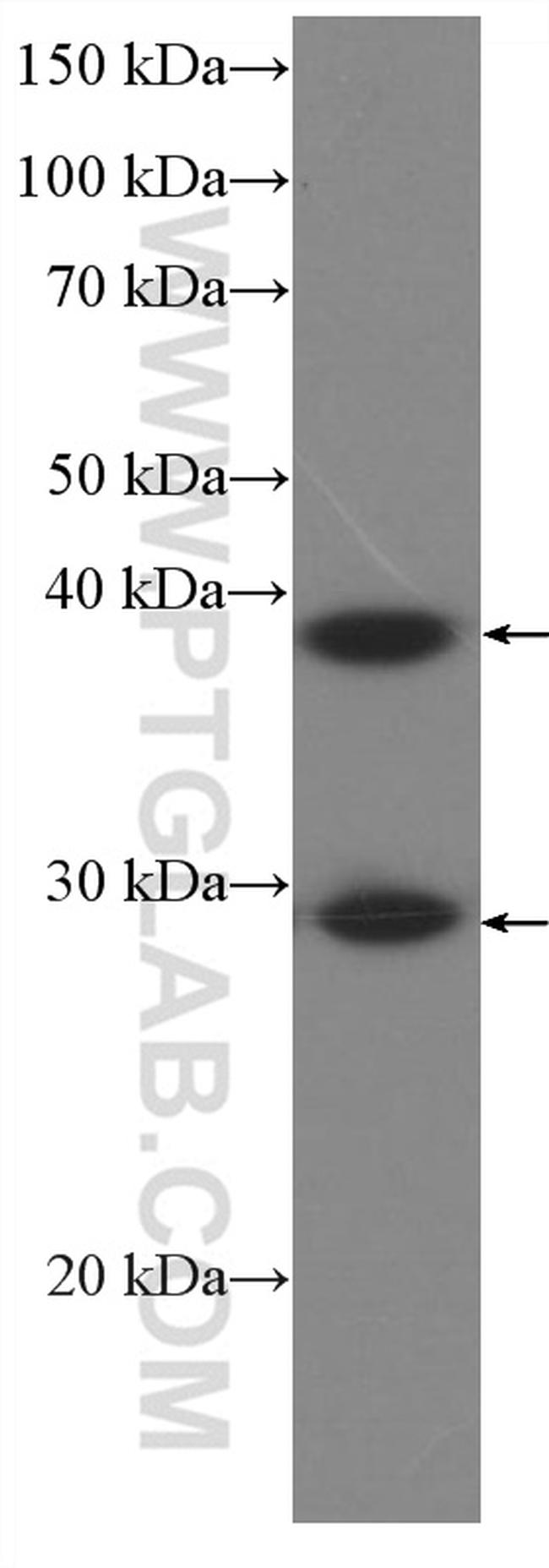 DNAJB6 Antibody in Western Blot (WB)