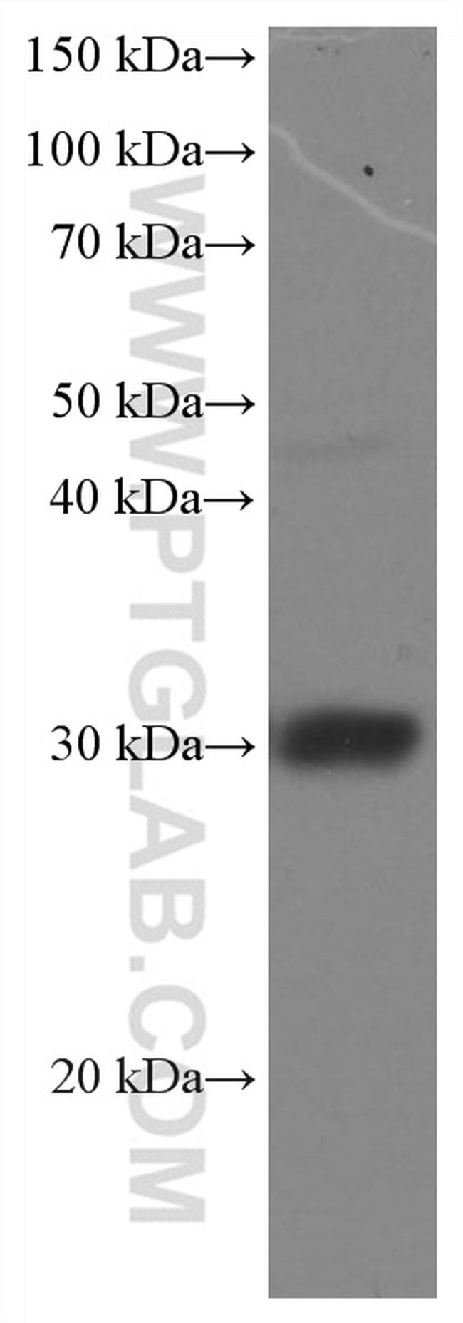 DNAJB6 Antibody in Western Blot (WB)