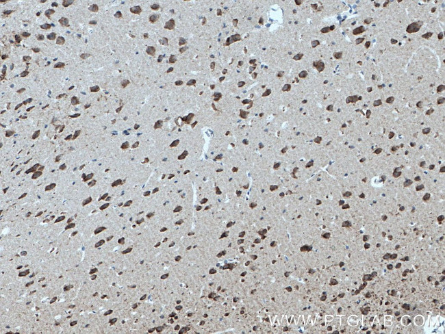 DNAJB6 Antibody in Immunohistochemistry (Paraffin) (IHC (P))