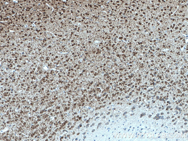 DNAJB6 Antibody in Immunohistochemistry (Paraffin) (IHC (P))