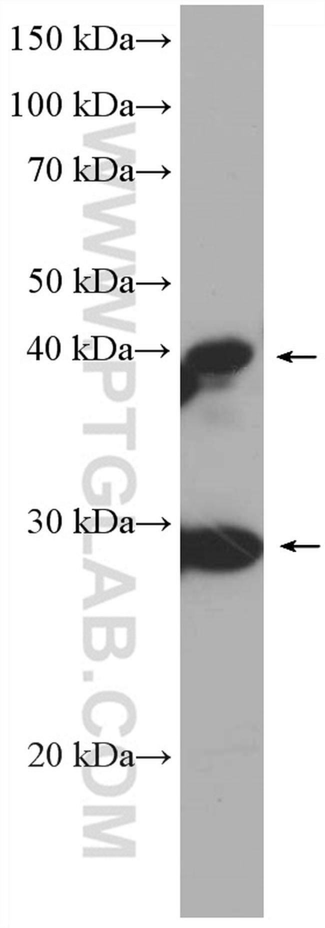 DNAJB6 Antibody in Western Blot (WB)