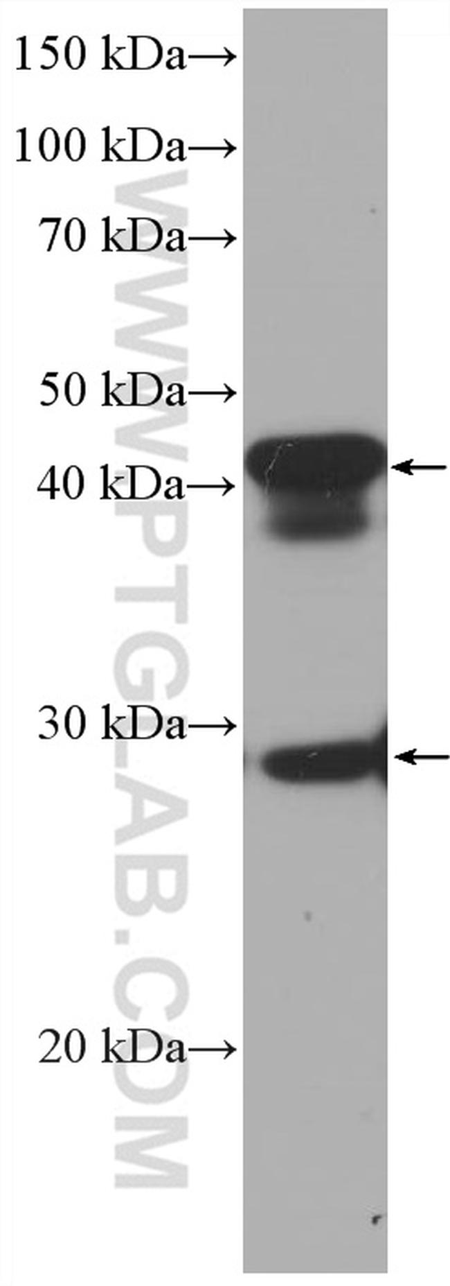 DNAJB6 Antibody in Western Blot (WB)