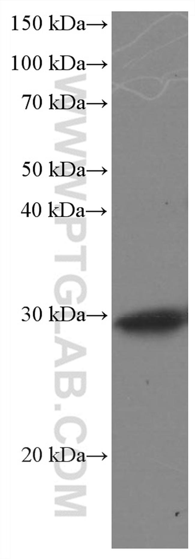 DNAJB6 Antibody in Western Blot (WB)