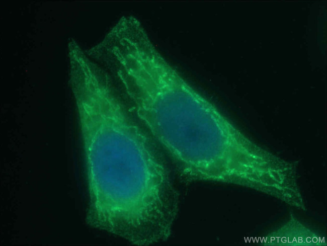 SDHA Antibody in Immunocytochemistry (ICC/IF)