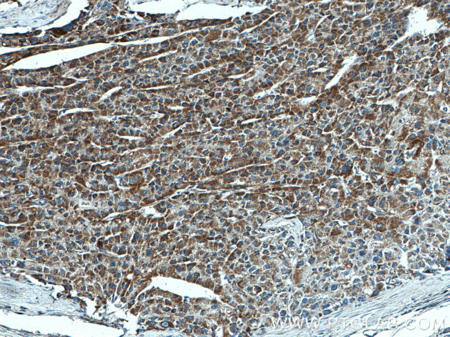 SDHA Antibody in Immunohistochemistry (Paraffin) (IHC (P))