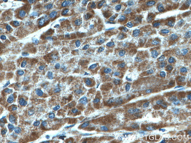 SDHA Antibody in Immunohistochemistry (Paraffin) (IHC (P))