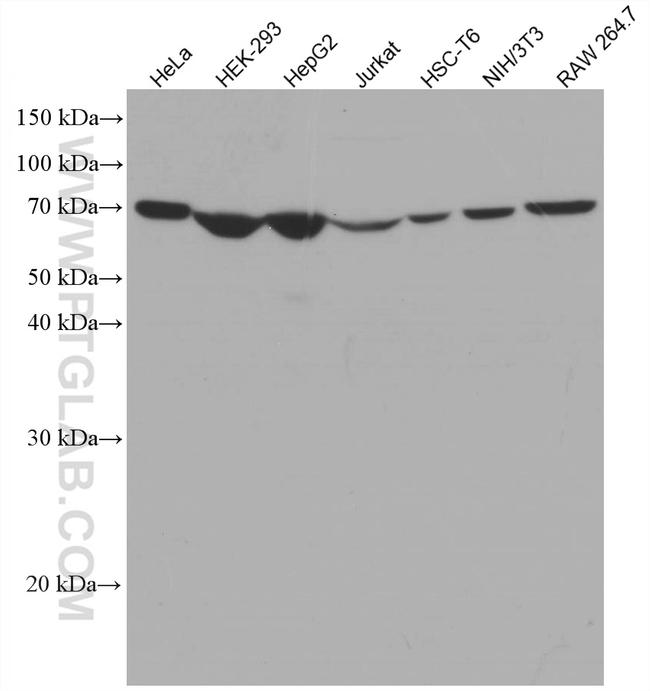 SDHA Antibody in Western Blot (WB)