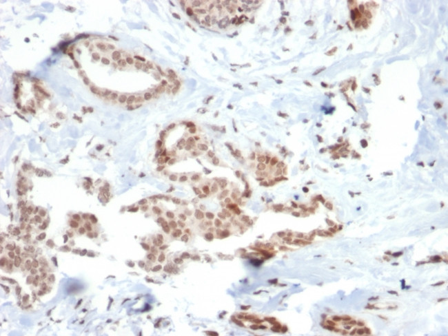 SOX4 (Master Regulator of Epithelial-Mesenchymal Transition) Antibody in Immunohistochemistry (Paraffin) (IHC (P))