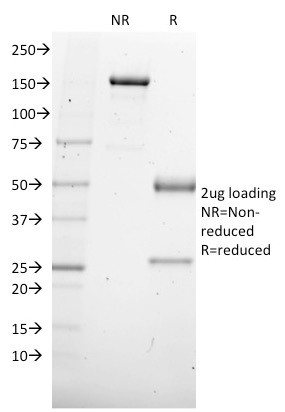 SOX4 (Master Regulator of Epithelial-Mesenchymal Transition) Antibody in SDS-PAGE (SDS-PAGE)