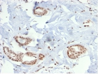 SOX4 (Master Regulator of Epithelial-Mesenchymal Transition) Antibody in Immunohistochemistry (Paraffin) (IHC (P))