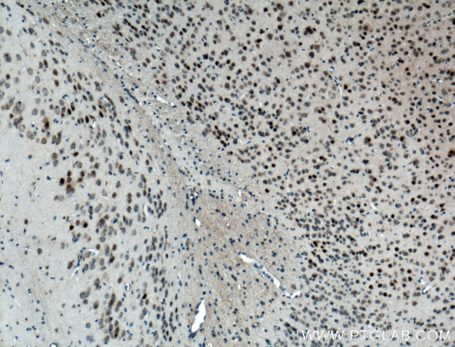 FOS Antibody in Immunohistochemistry (Paraffin) (IHC (P))