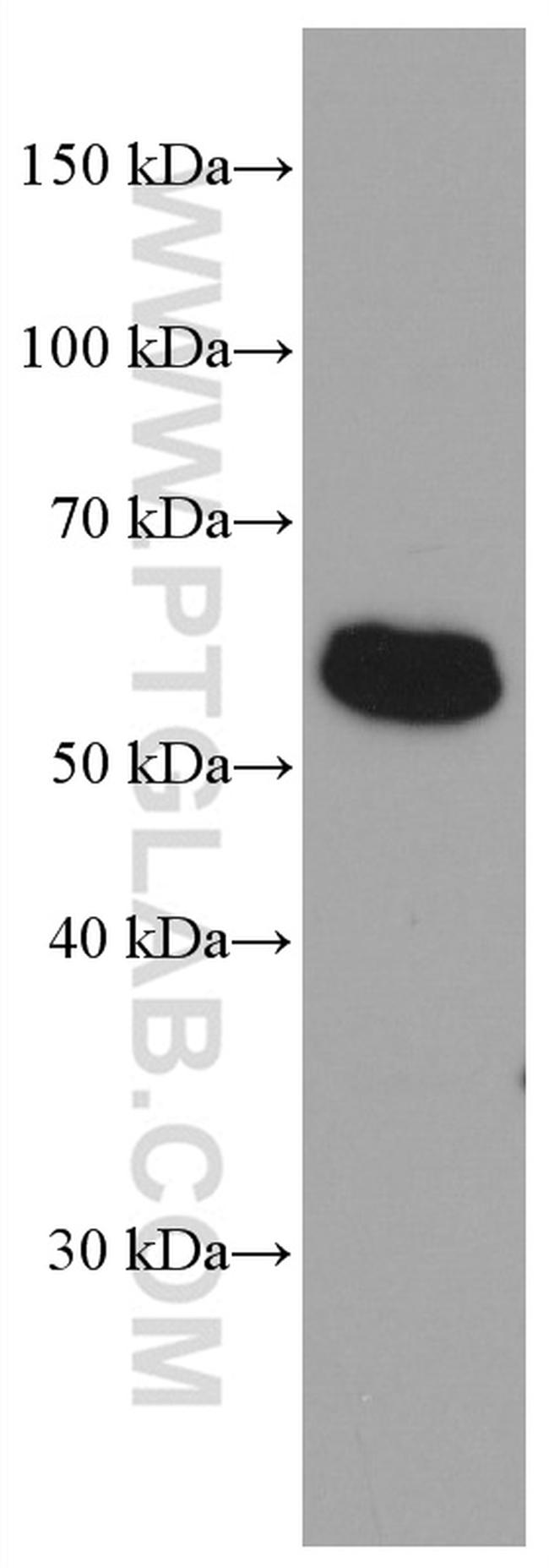 FOS Antibody in Western Blot (WB)