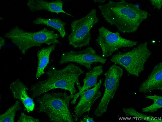 FASN Antibody in Immunocytochemistry (ICC/IF)