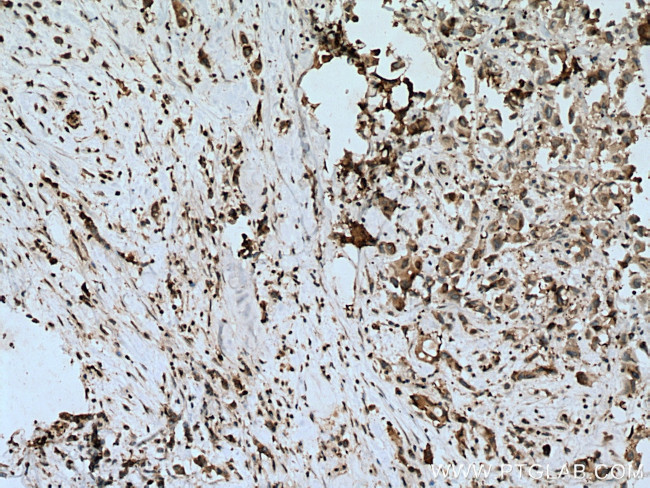 FASN Antibody in Immunohistochemistry (Paraffin) (IHC (P))