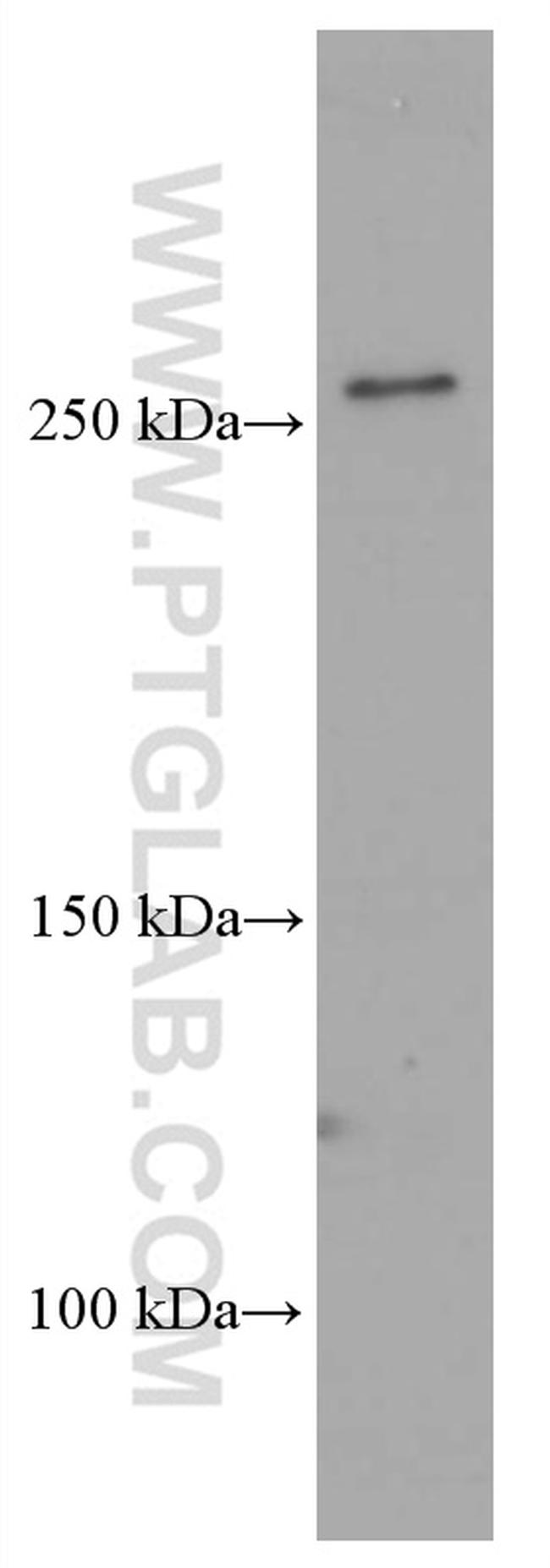 FASN Antibody in Western Blot (WB)