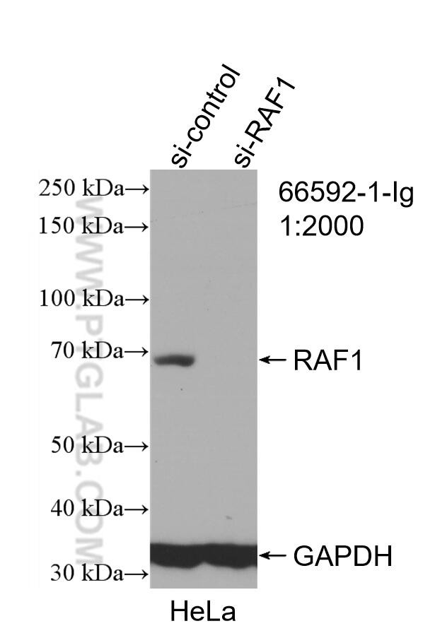 RAF1 Antibody in Western Blot (WB)