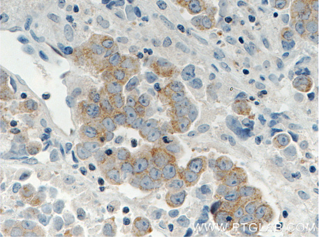 RAF1 Antibody in Immunohistochemistry (Paraffin) (IHC (P))