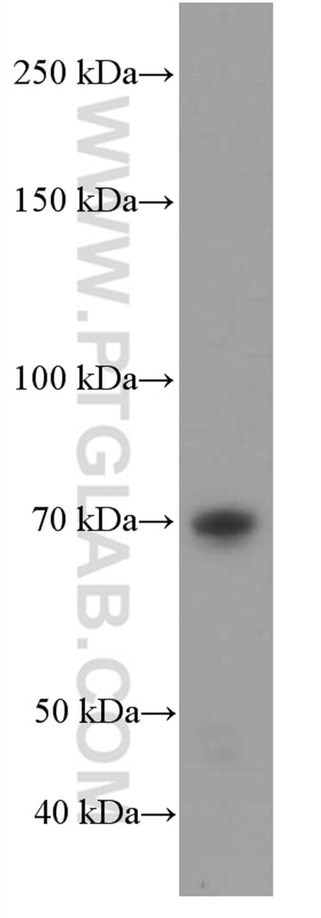 RAF1 Antibody in Western Blot (WB)