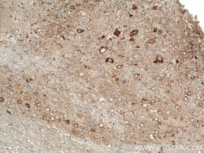 TOM70 Antibody in Immunohistochemistry (Paraffin) (IHC (P))