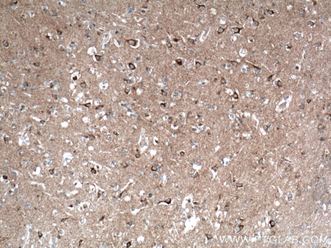 TOM70 Antibody in Immunohistochemistry (Paraffin) (IHC (P))