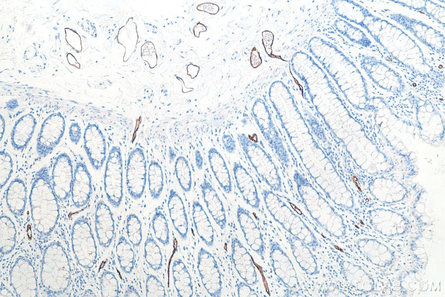 MAdCAM1 Antibody in Immunohistochemistry (Paraffin) (IHC (P))