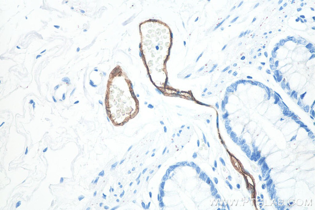 MAdCAM1 Antibody in Immunohistochemistry (Paraffin) (IHC (P))