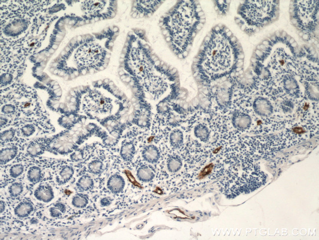 MAdCAM1 Antibody in Immunohistochemistry (Paraffin) (IHC (P))