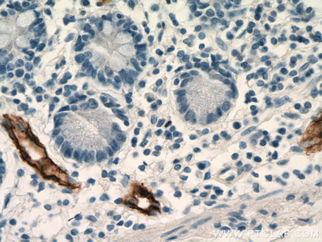 MAdCAM1 Antibody in Immunohistochemistry (Paraffin) (IHC (P))