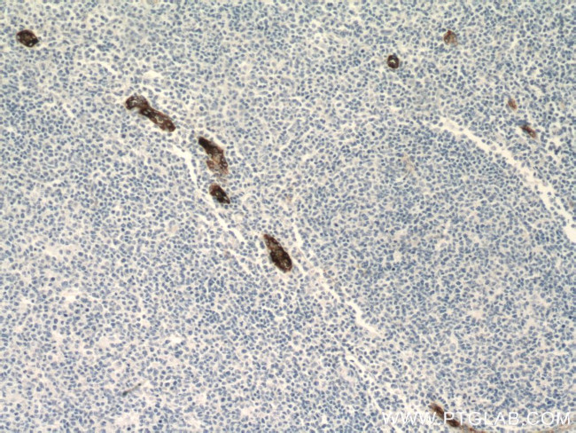 MAdCAM1 Antibody in Immunohistochemistry (Paraffin) (IHC (P))