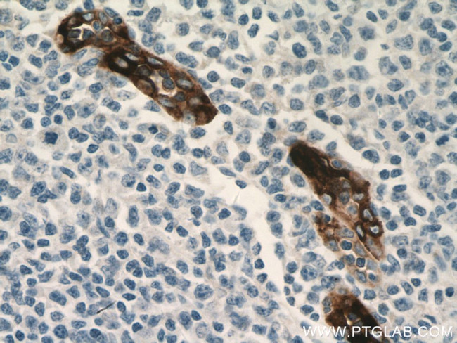 MAdCAM1 Antibody in Immunohistochemistry (Paraffin) (IHC (P))