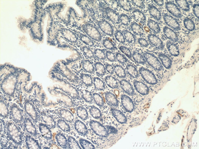 MAdCAM1 Antibody in Immunohistochemistry (Paraffin) (IHC (P))