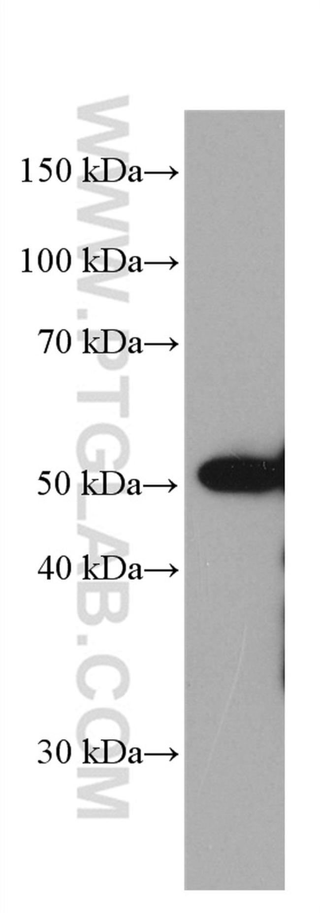 ETS1 Antibody in Western Blot (WB)