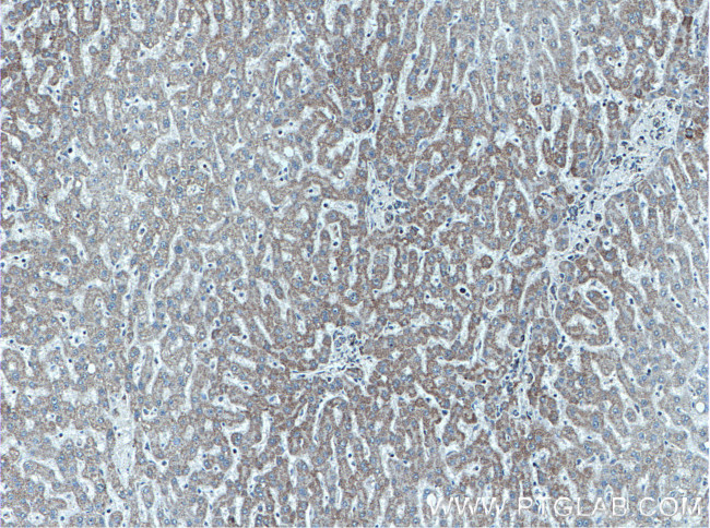 ATPB Antibody in Immunohistochemistry (Paraffin) (IHC (P))