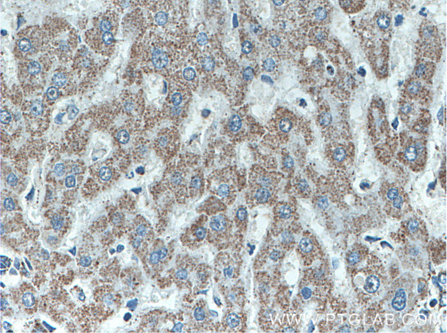 ATPB Antibody in Immunohistochemistry (Paraffin) (IHC (P))