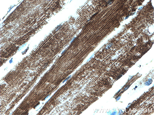 ATPB Antibody in Immunohistochemistry (Paraffin) (IHC (P))