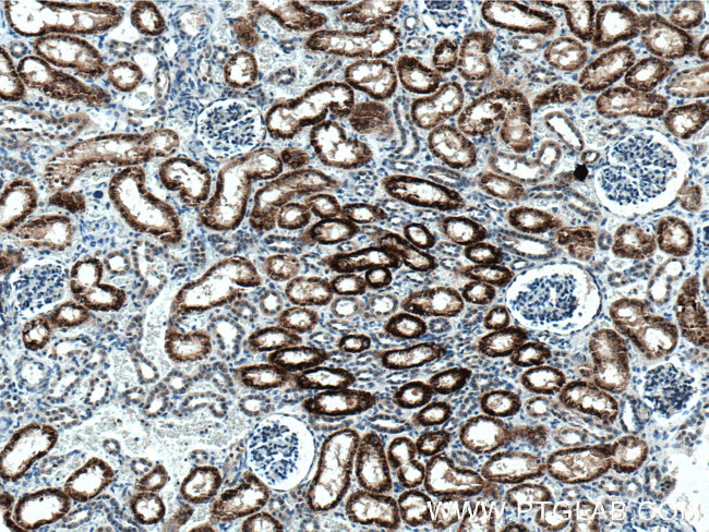 AGXT2 Antibody in Immunohistochemistry (Paraffin) (IHC (P))